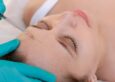 Comprehensive Botox Treatment Options in Boerne