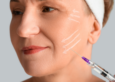 Dermal Fillers in New Braunfels, Texas