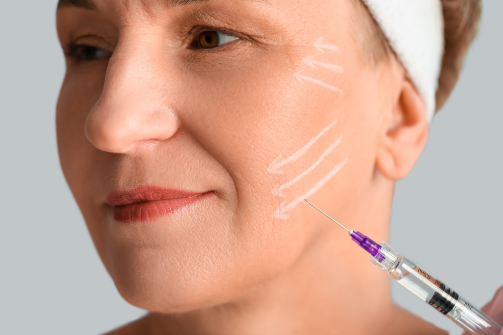 Dermal Fillers in New Braunfels, Texas