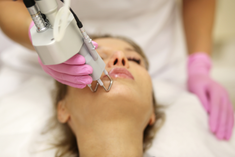 Skin Resurfacing Treatments in Boerne, Texas