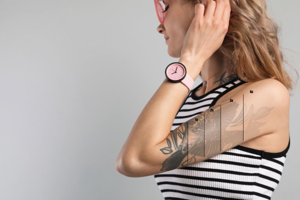 Tattoo Removal Prices in Bulverde, Texas