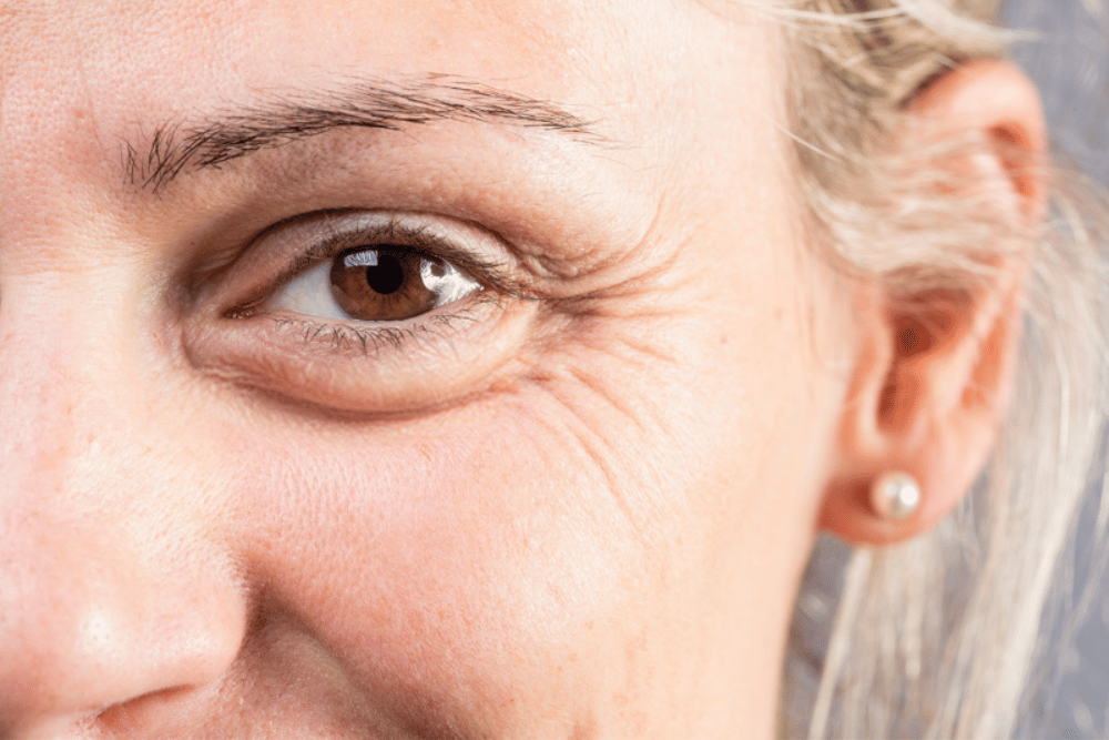 Botox Price Per Unit Spring Branch TX