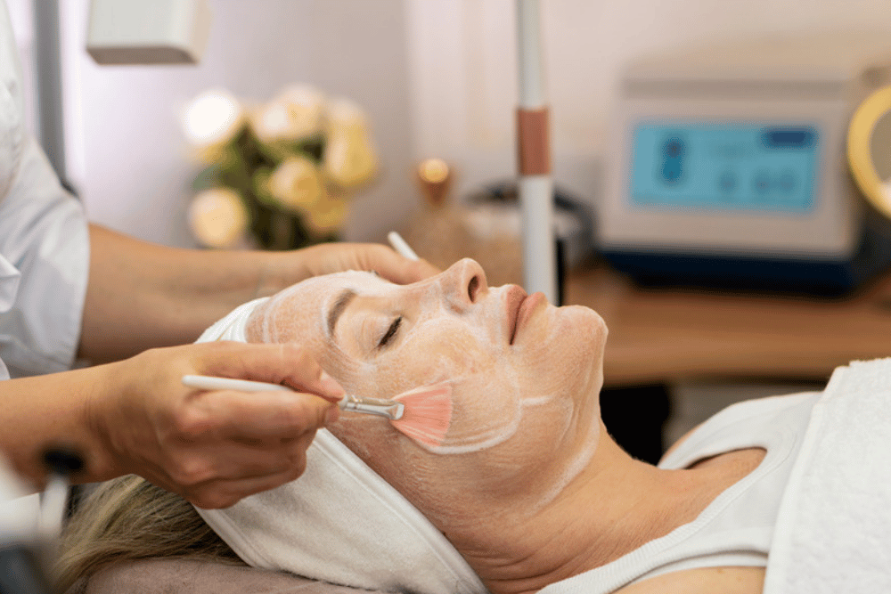 Chemical Peels in Bulverde TX
