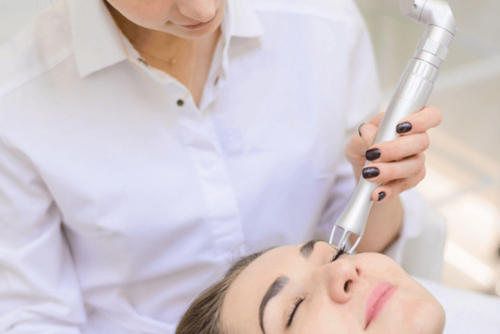 Fractional Laser Resurfacing in New Braunfels TX