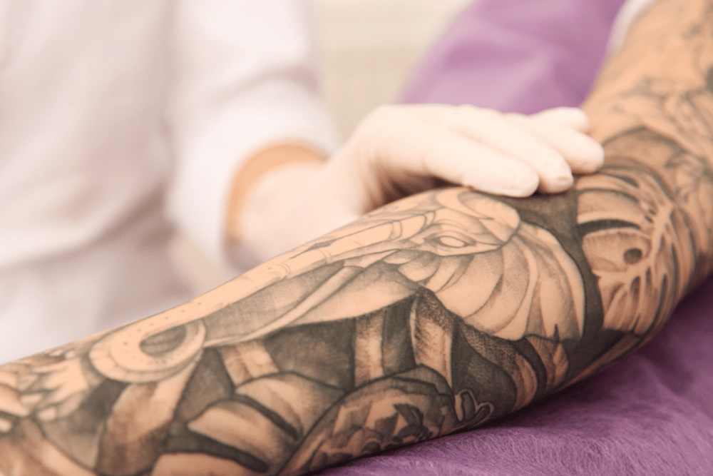 tattoo removal near Canyon Lake TX